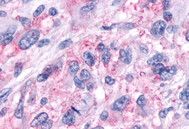 GPR161 Antibody in Immunohistochemistry (Paraffin) (IHC (P))