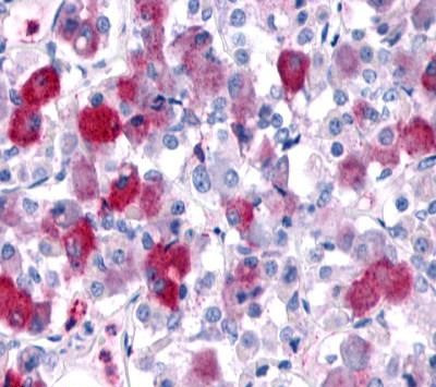 GPR161 Antibody in Immunohistochemistry (Paraffin) (IHC (P))