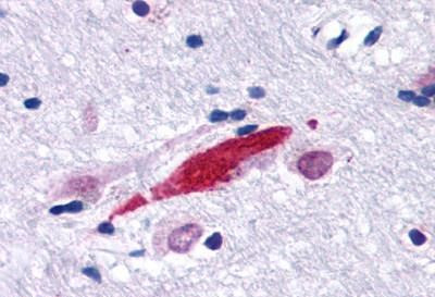 GPR30 Antibody in Immunohistochemistry (Paraffin) (IHC (P))