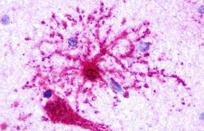 GPR35 Antibody in Immunohistochemistry (Paraffin) (IHC (P))