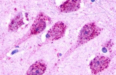 GPR35 Antibody in Immunohistochemistry (Paraffin) (IHC (P))