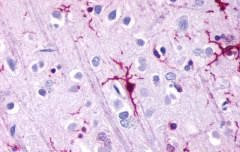 GPR39 Antibody in Immunohistochemistry (Paraffin) (IHC (P))