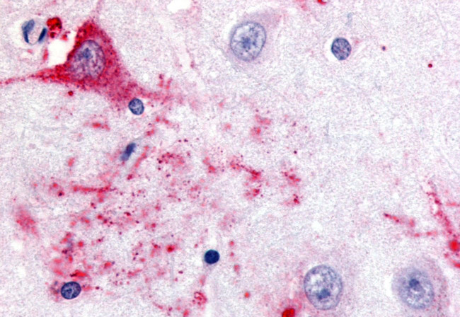 GPR39 Antibody in Immunohistochemistry (Paraffin) (IHC (P))