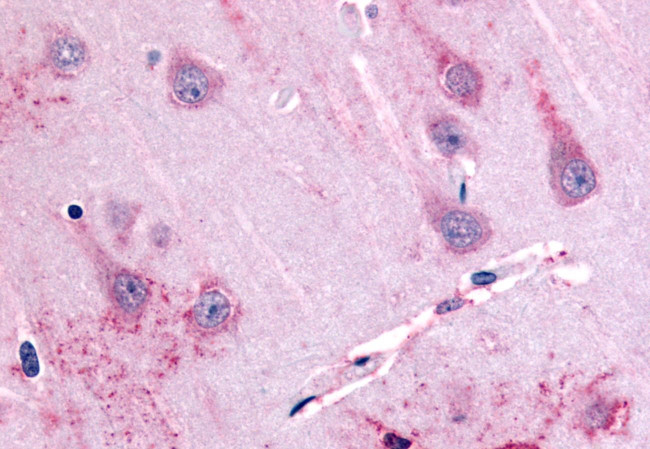 GPR39 Antibody in Immunohistochemistry (Paraffin) (IHC (P))