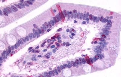 GPR39 Antibody in Immunohistochemistry (Paraffin) (IHC (P))