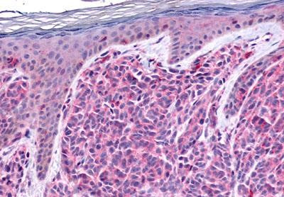 GPR4 Antibody in Immunohistochemistry (Paraffin) (IHC (P))