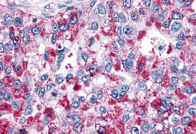 GPR4 Antibody in Immunohistochemistry (Paraffin) (IHC (P))