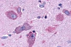 CRTH2 Antibody in Immunohistochemistry (Paraffin) (IHC (P))