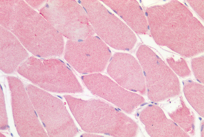 LGR5 Antibody in Immunohistochemistry (Paraffin) (IHC (P))