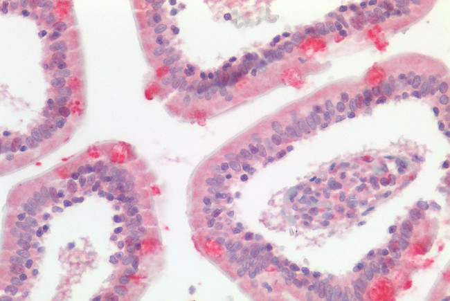 LGR5 Antibody in Immunohistochemistry (Paraffin) (IHC (P))