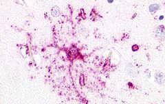 GPR52 Antibody in Immunohistochemistry (Paraffin) (IHC (P))