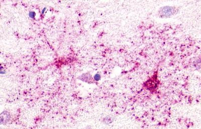 GPR52 Antibody in Immunohistochemistry (Paraffin) (IHC (P))