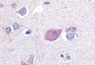 GPR55 Antibody in Immunohistochemistry (Paraffin) (IHC (P))