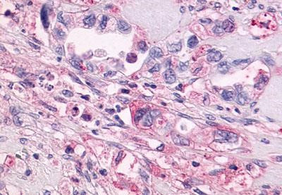 GPR55 Antibody in Immunohistochemistry (Paraffin) (IHC (P))