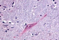 GPR55 Antibody in Immunohistochemistry (Paraffin) (IHC (P))