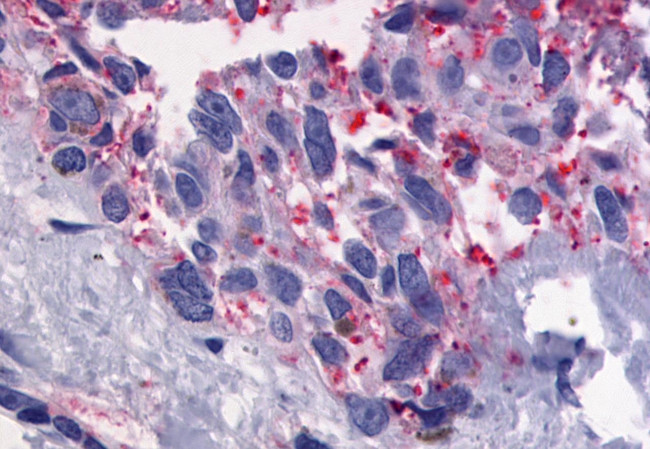 GPR56 Antibody in Immunohistochemistry (Paraffin) (IHC (P))