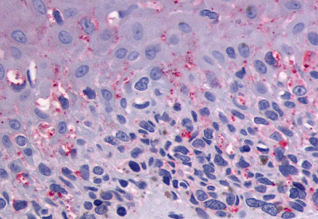 GPR56 Antibody in Immunohistochemistry (Paraffin) (IHC (P))