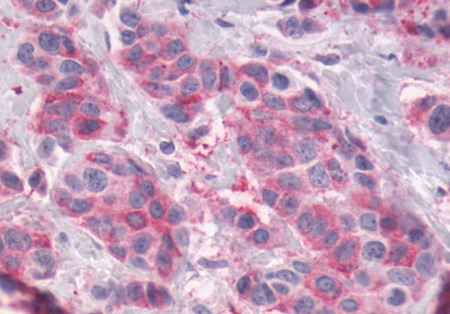 GPR56 Antibody in Immunohistochemistry (Paraffin) (IHC (P))