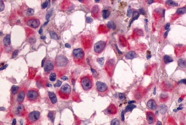 GPR64 Antibody in Immunohistochemistry (Paraffin) (IHC (P))