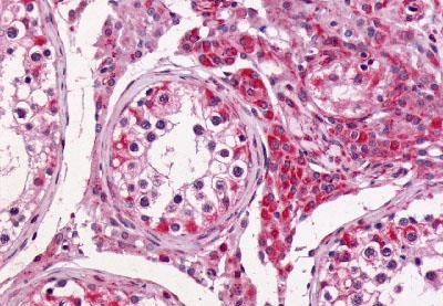 GPR64 Antibody in Immunohistochemistry (Paraffin) (IHC (P))