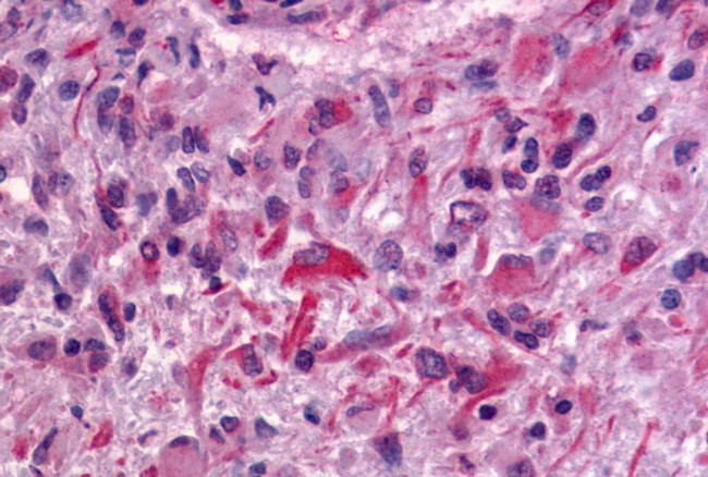 GPR64 Antibody in Immunohistochemistry (Paraffin) (IHC (P))