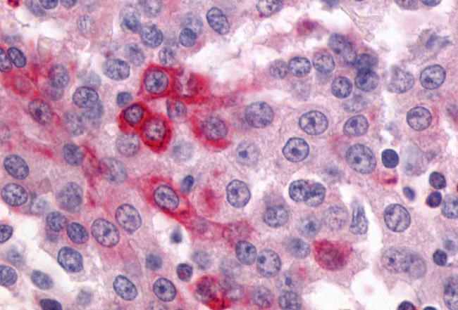 GPR64 Antibody in Immunohistochemistry (Paraffin) (IHC (P))