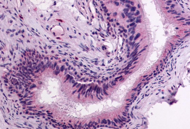 GPR64 Antibody in Immunohistochemistry (Paraffin) (IHC (P))