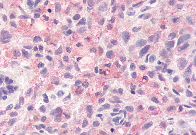 GPR78 Antibody in Immunohistochemistry (Paraffin) (IHC (P))