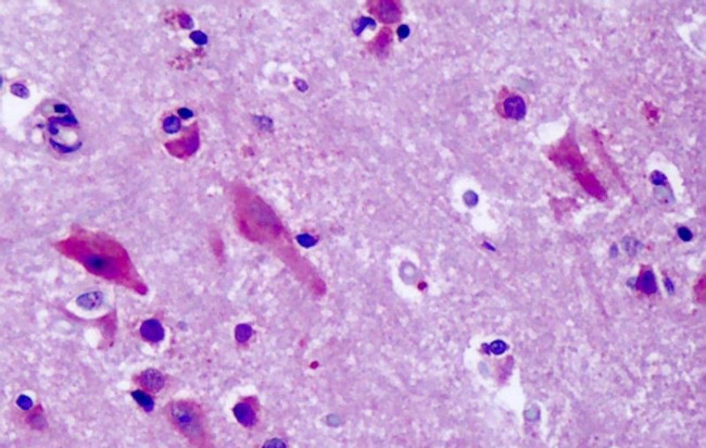 GPR83 Antibody in Immunohistochemistry (Paraffin) (IHC (P))