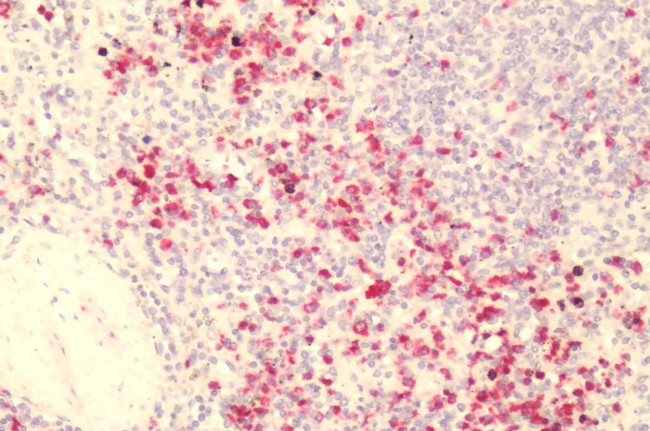 GPR84 Antibody in Immunohistochemistry (Paraffin) (IHC (P))