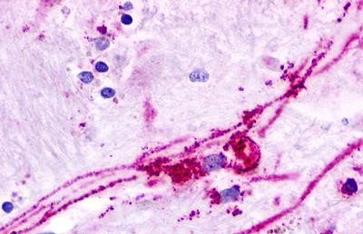 GPR84 Antibody in Immunohistochemistry (Paraffin) (IHC (P))