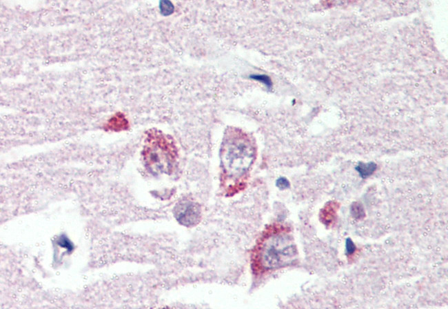 GPR98 Antibody in Immunohistochemistry (Paraffin) (IHC (P))