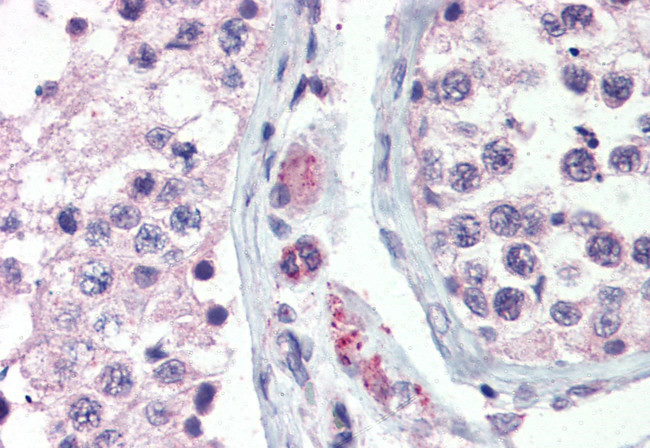 GPR98 Antibody in Immunohistochemistry (Paraffin) (IHC (P))