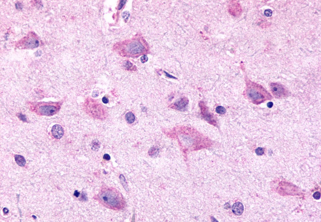 GPR98 Antibody in Immunohistochemistry (Paraffin) (IHC (P))