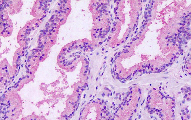 RAI3 Antibody in Immunohistochemistry (Paraffin) (IHC (P))