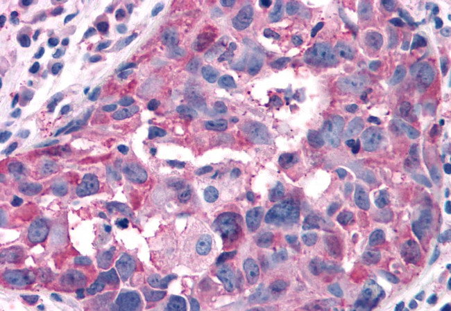 RAI3 Antibody in Immunohistochemistry (Paraffin) (IHC (P))