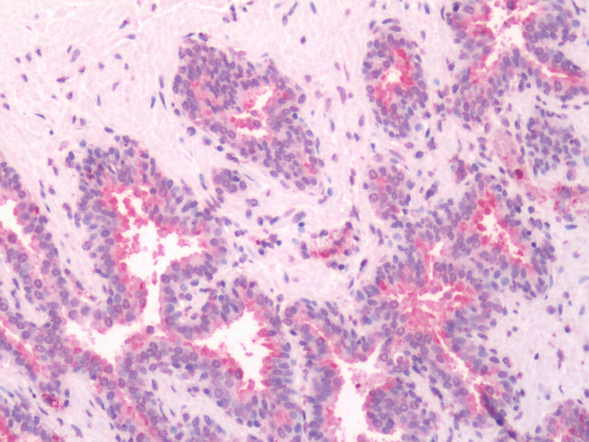 RAI3 Antibody in Immunohistochemistry (Paraffin) (IHC (P))