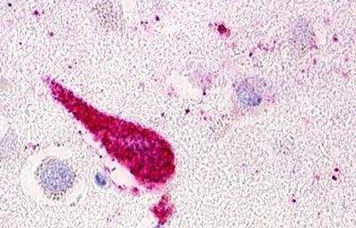 GPRC5D Antibody in Immunohistochemistry (Paraffin) (IHC (P))