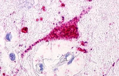 GPRC5D Antibody in Immunohistochemistry (Paraffin) (IHC (P))