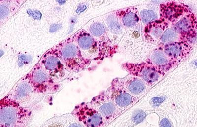 GPRC5D Antibody in Immunohistochemistry (Paraffin) (IHC (P))