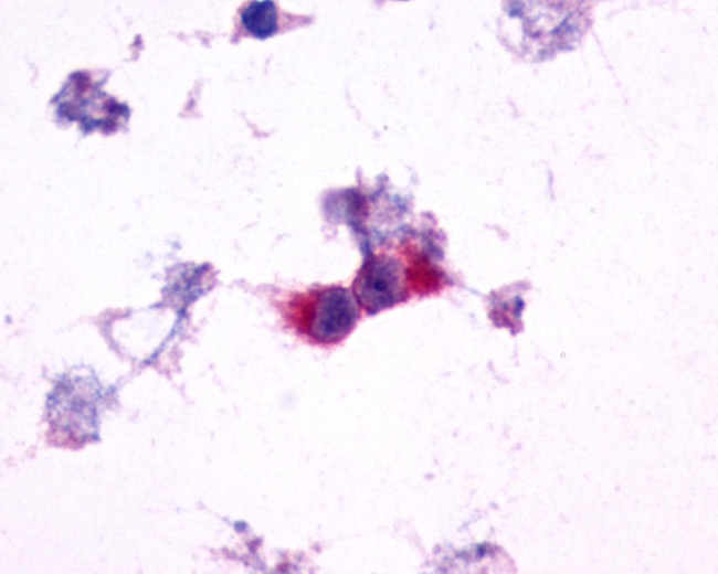 mGluR2 Antibody in Immunocytochemistry (ICC/IF)