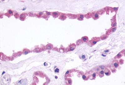 mGluR3 Antibody in Immunohistochemistry (Paraffin) (IHC (P))