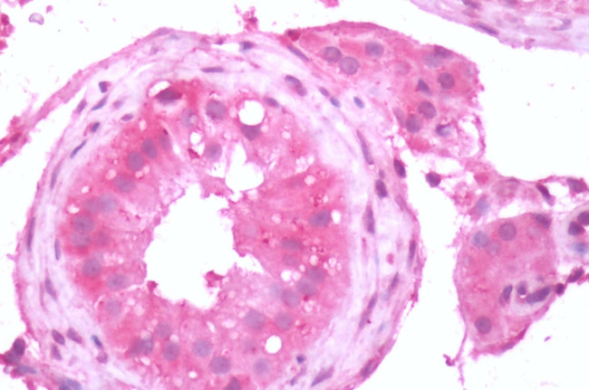 mGluR3 Antibody in Immunohistochemistry (Paraffin) (IHC (P))