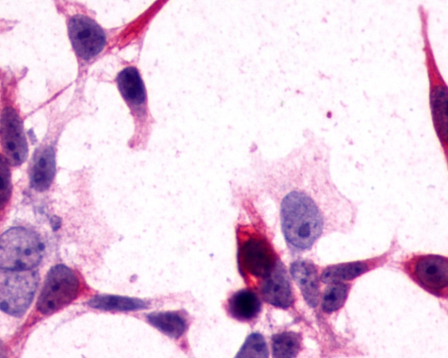 mGluR3 Antibody in Immunocytochemistry (ICC/IF)