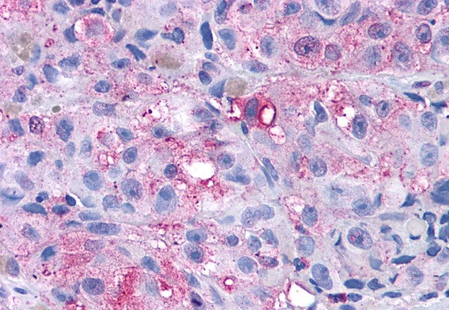 mGluR4 Antibody in Immunohistochemistry (Paraffin) (IHC (P))