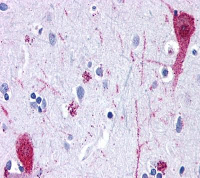 mGluR4 Antibody in Immunohistochemistry (Paraffin) (IHC (P))