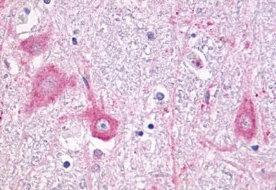 mGluR5 Antibody in Immunohistochemistry (Paraffin) (IHC (P))