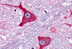 mGluR5 Antibody in Immunohistochemistry (Paraffin) (IHC (P))