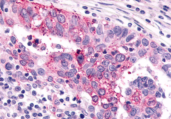 mGluR6 Antibody in Immunohistochemistry (Paraffin) (IHC (P))