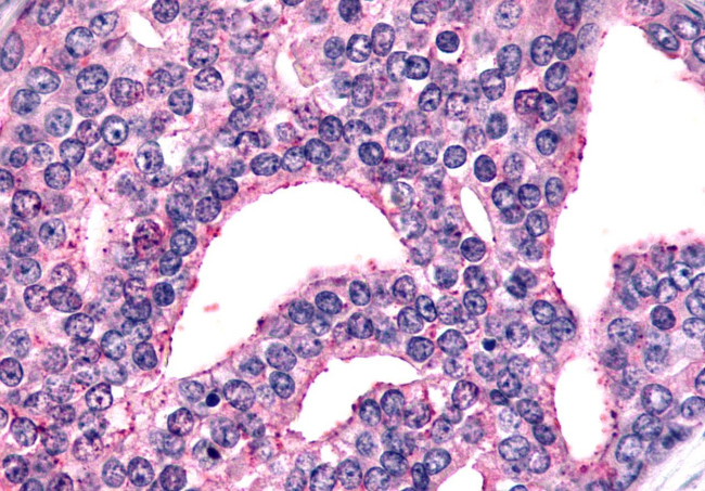 mGluR6 Antibody in Immunohistochemistry (Paraffin) (IHC (P))